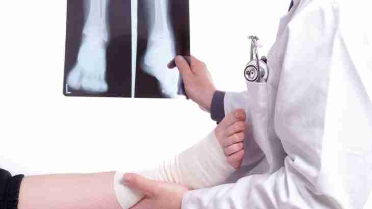 Doctor examining a bandaged ankle and foot whilst pointing to X-rays showing a fractured ankle injury