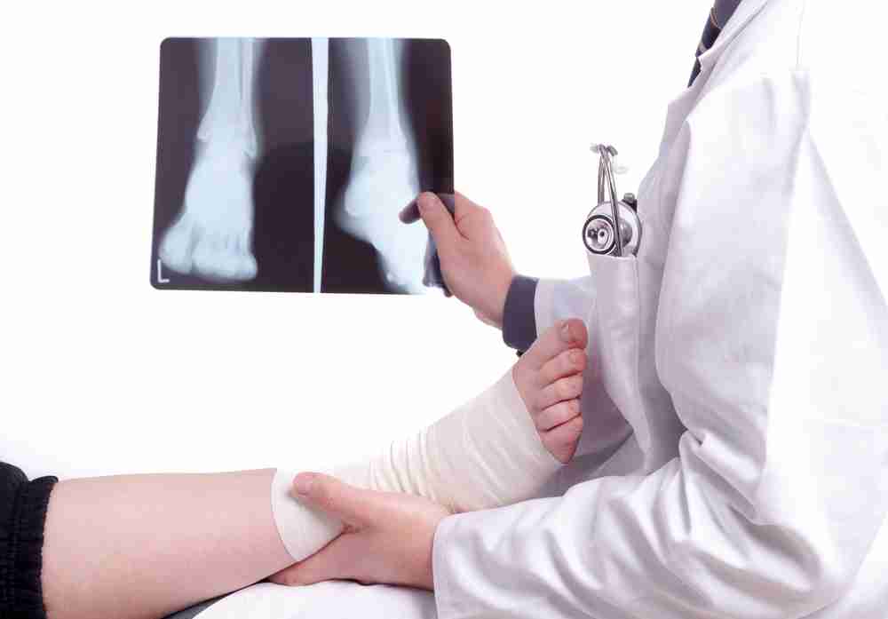Doctor examining a bandaged ankle and foot whilst pointing to X-rays showing a fractured ankle injury