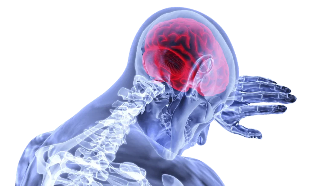 brain injury compensation claim
