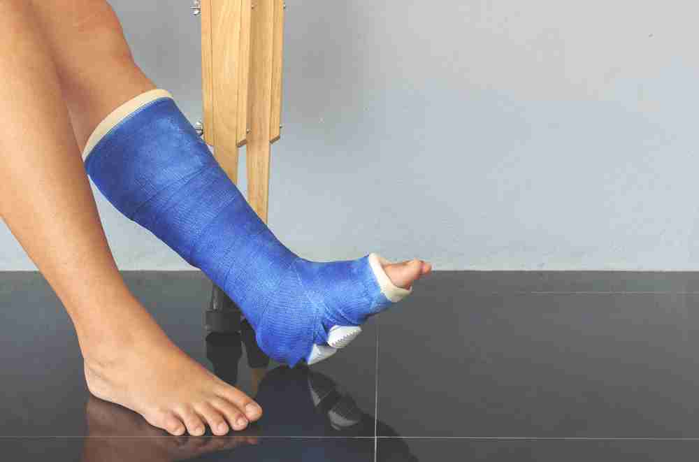 Broken ankle injury requiring a surgical walking boot and crutches Patient wearing a surgical walking boot on an injured ankle with crutches visible in the background