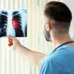claim mesothelioma compensation overseas