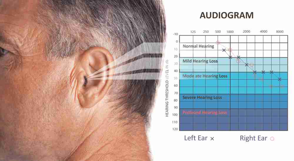 hearing test audiogram