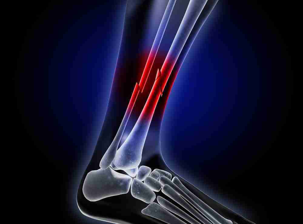 injury compensation norfolk