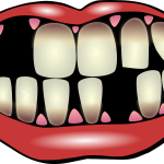 Tooth Injury Claim Illustration of a mouth with missing teeth