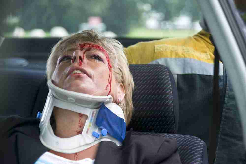 woman in a car accident with a neck brace and with a bleeding forehead considering compensation for a skull fracture claim