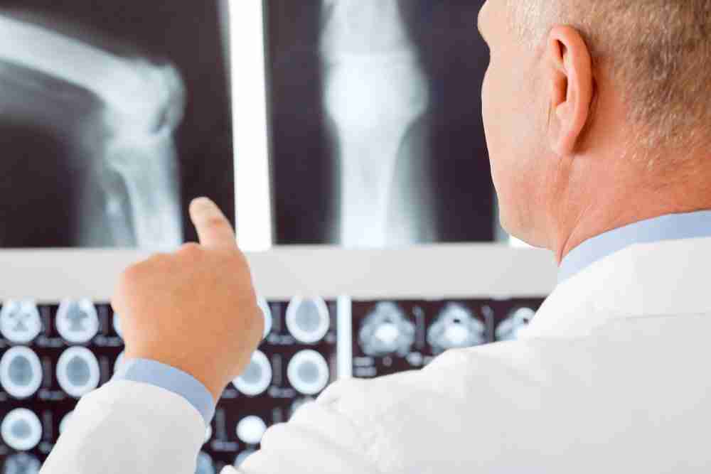Torn Cartilage