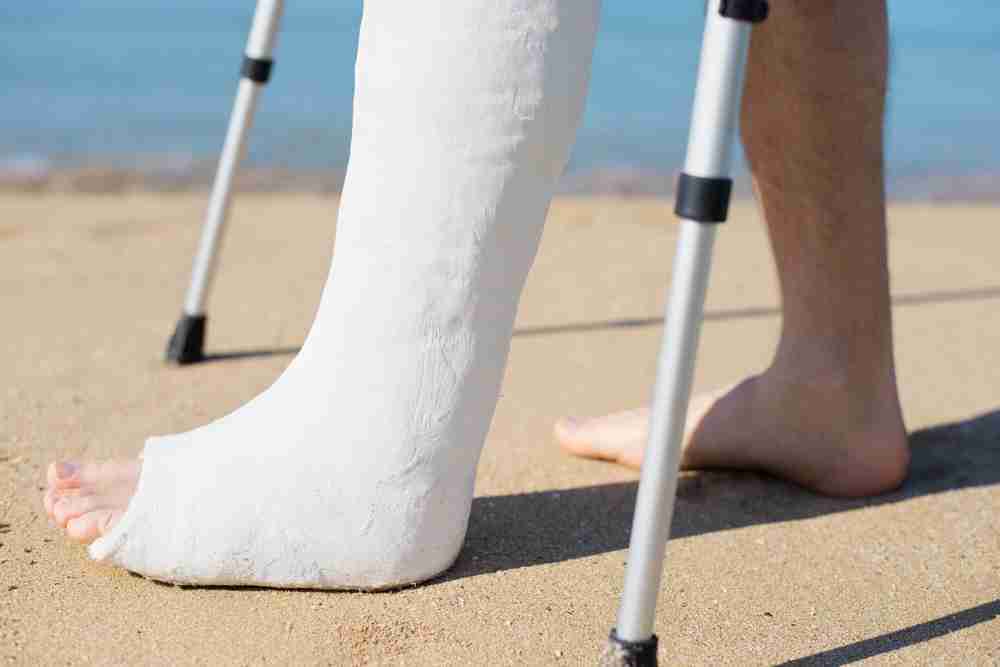 Man in plaster with crutches walking on a holiday beach travel insurance legal expenses