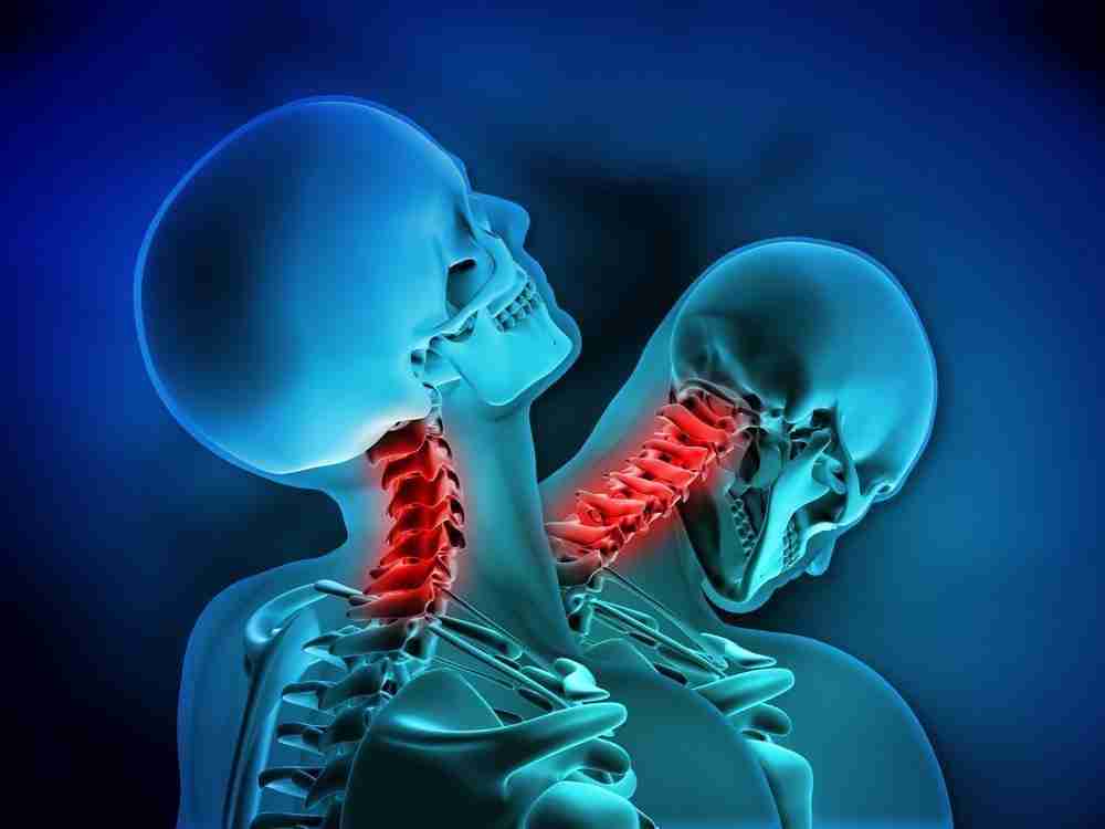 whiplash knee injury london